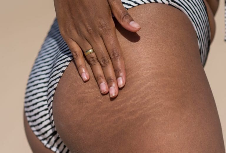 Ardo Natal Anti-stretch through pregnancy and beyond